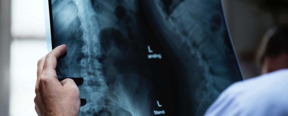 Do I have to keep going to the Chiropractor once I start?